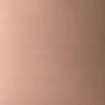 Glossy - Bottle Openers Now