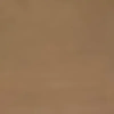 Glossy - Bottle Openers Now